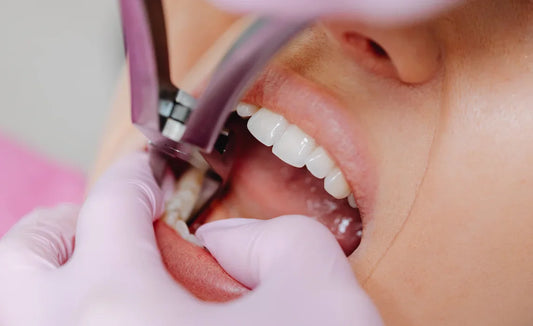When Do Wisdom Teeth Come In? Signs, Ages, and What to Expect