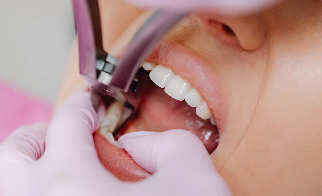 When Do Wisdom Teeth Come In? Signs,   Ages, and What to Expect